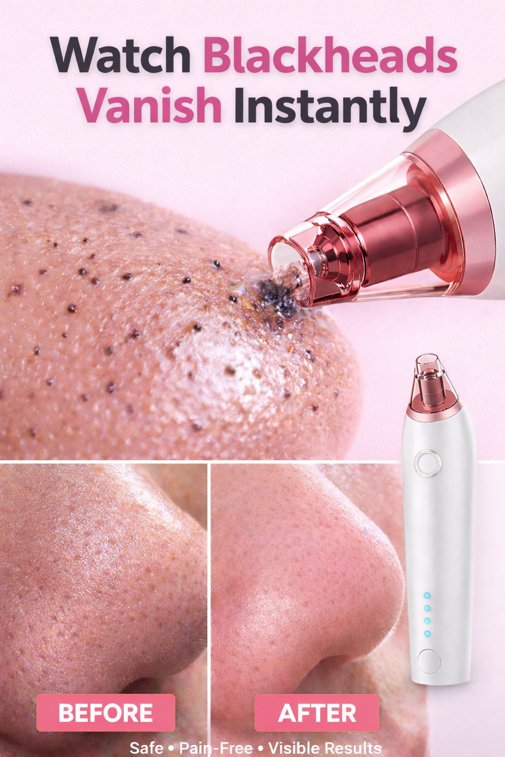 Deep Pore Blackhead Vacuum – Clear Skin in Minutes